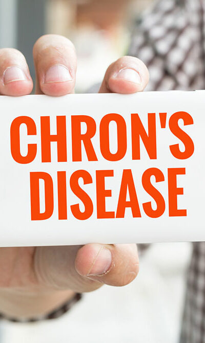 All You Need to Know about Chron’s disease