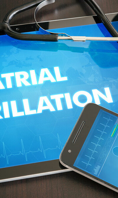 All You Need to Know about Atrial Fibrillation