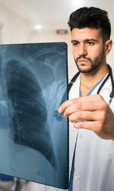 All You Need to Know about Pulmonary Embolism