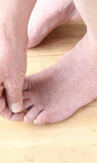 Diabetic Neuropathy – Risk Factors, Symptoms, and Treatments