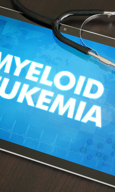 Diagnosis and treatment of chronic myeloid leukemia