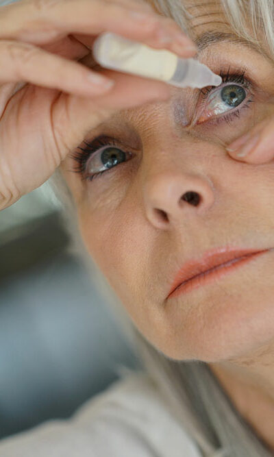 Dry Eyes – Symptoms, Causes, and Treatment Options