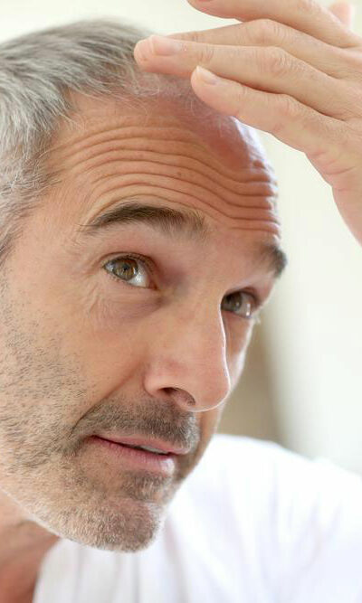 Essential Vitamins for Preventing Hair Loss