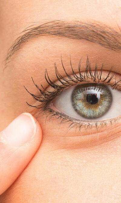 How to Get Rid of Under Eye Bags Naturally