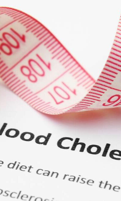 High Cholesterol – Symptoms and Treatment Options