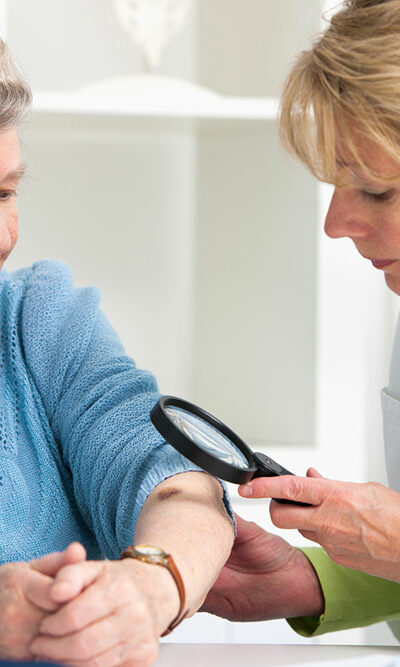 Managing melanoma with high-fiber foods