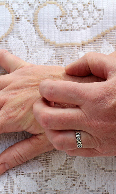 Scabies – Symptoms, Causes, and Treatment Options