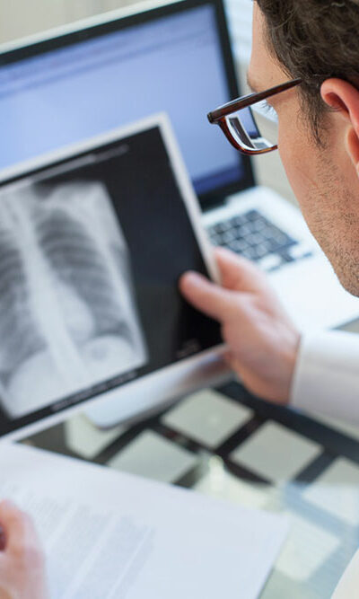 Pneumonia – Symptoms, Causes, Risk Factors, and Diagnosis