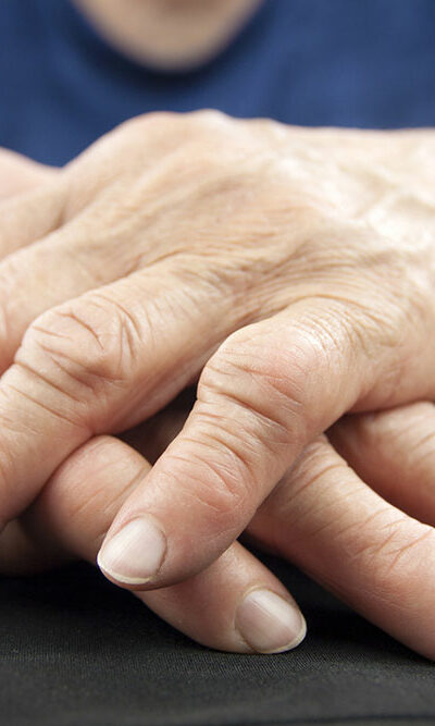 Rheumatoid Arthritis – Diagnosis and Treatment Options