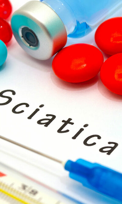 Top Treatment Options for Sciatica