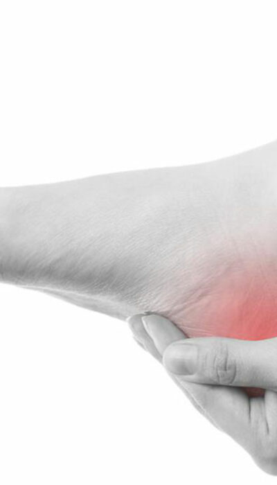 5 Natural Remedies for Treating Gout Pain