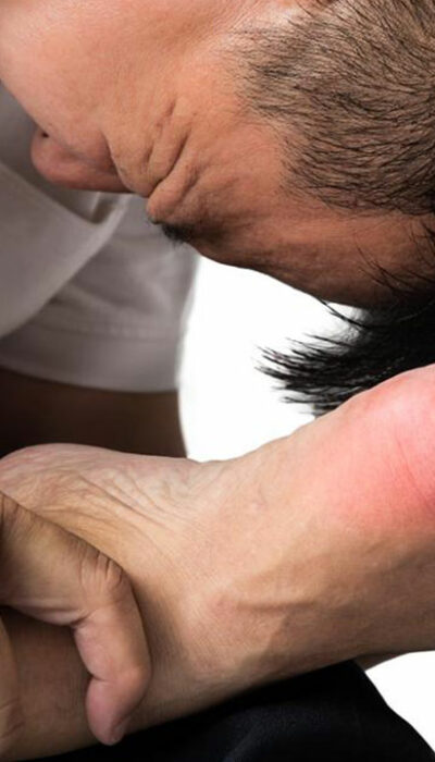 5 Effective Treatments for Gout