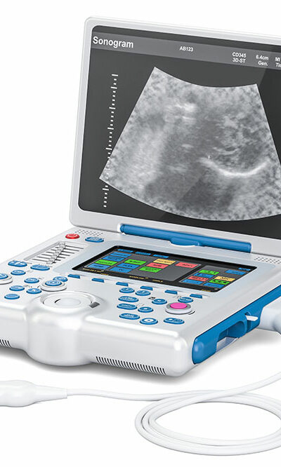 5 best portable ultrasound machines