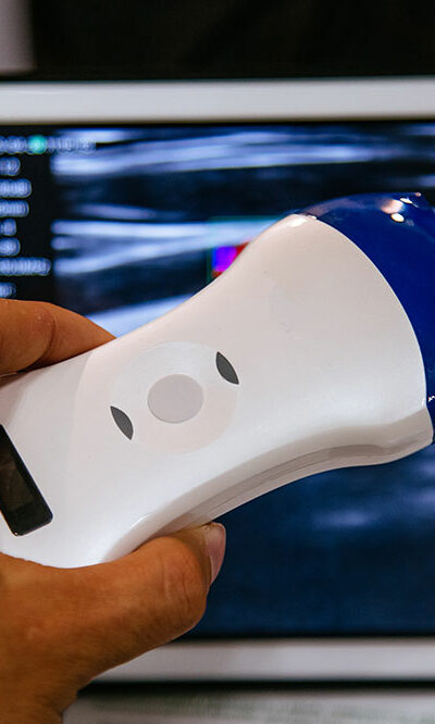 Benefits of portable ultrasound machines