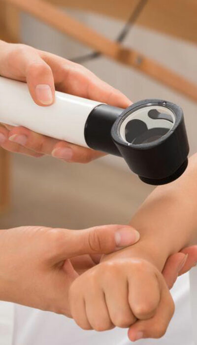 Eczema – Symptoms, Complications, and Treatment Options