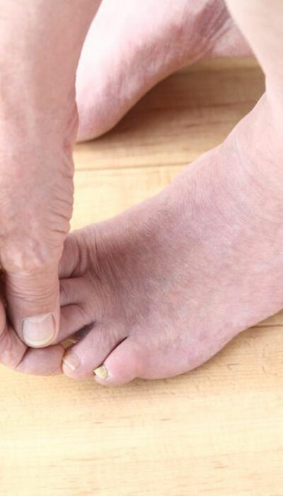Fibromyalgia Foot Pain – Factors to Understand