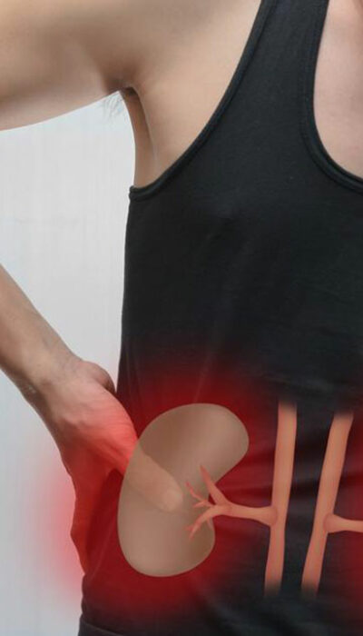 Kidney Failure – Causes and Symptoms