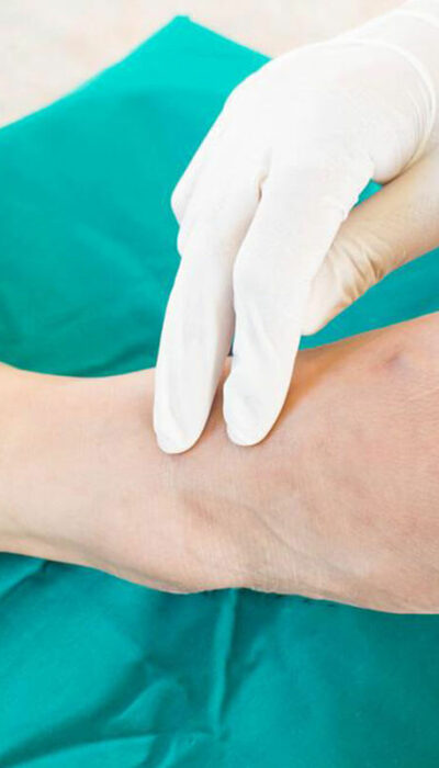 How to Alleviate Your Diabetes Foot Problems