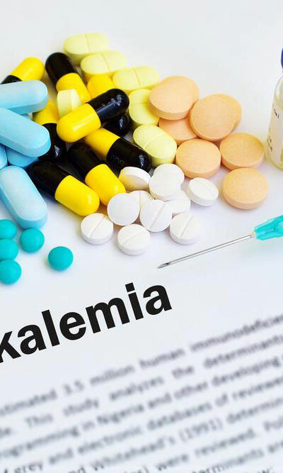 Hypokalemia – what you should know