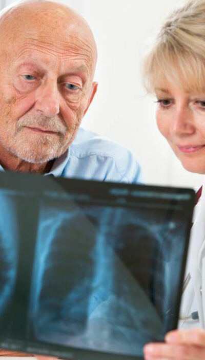 Pneumonia – Prognosis and Treatment Options