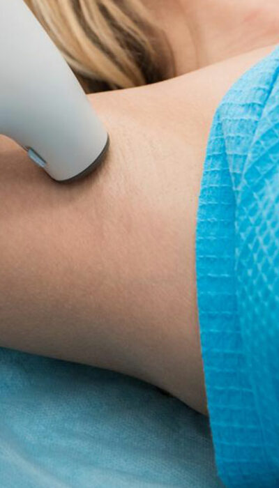 Popular Treatment Options for Hyperhidrosis