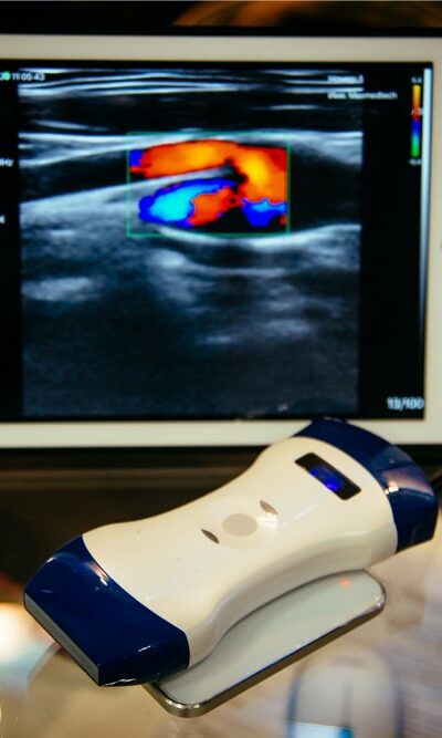 Portable ultrasound machines – Types and top choices