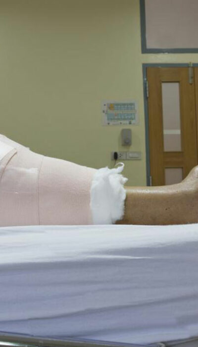 What You Need To Know About Knee Replacement Surgery