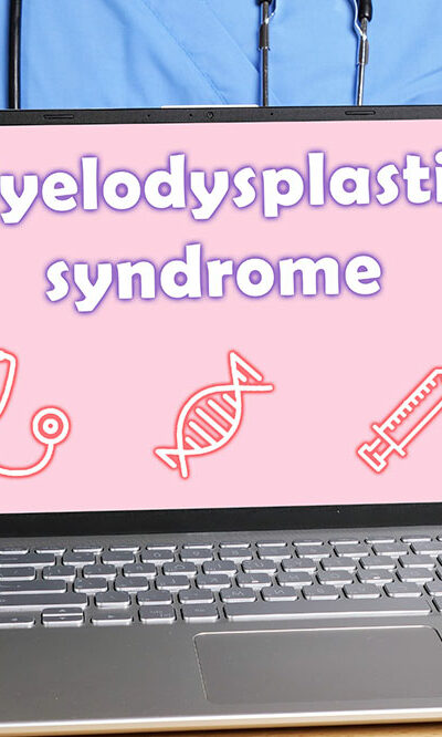 Top 3 management methods for myelodysplastic syndromes