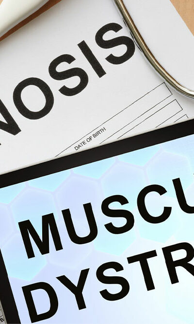 Common signs of muscular dystrophy