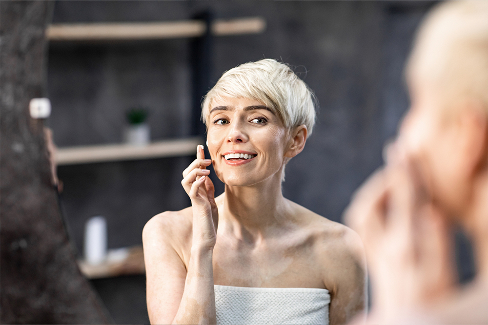 Uses of Opzelura for treating vitiligo